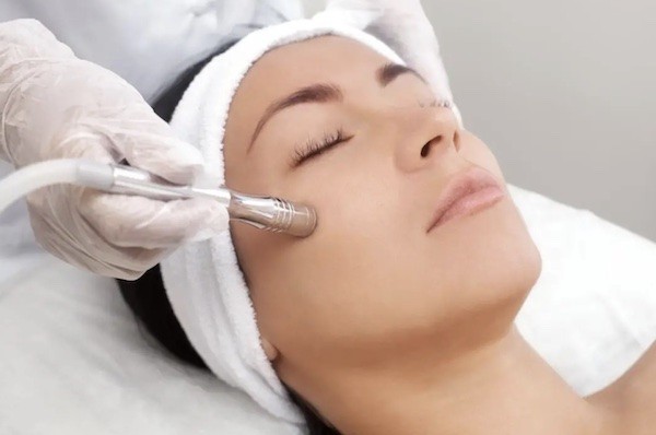 Microdermabrasion